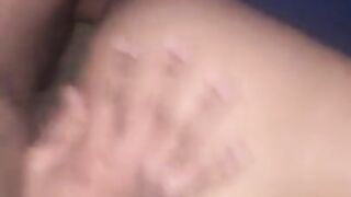Teen with marvelous birth mark creaming during the time that takin wang