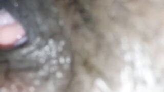 Black made me feel great after the surgery