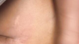 I GOT BANGED ON THE STOVE